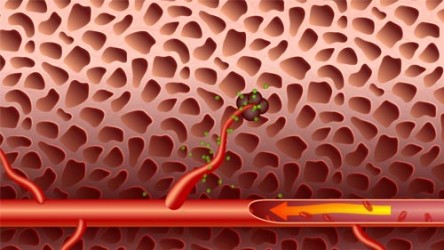 antiangiogenesis_anim_full